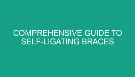 Comprehensive Guide to Self Ligating Braces