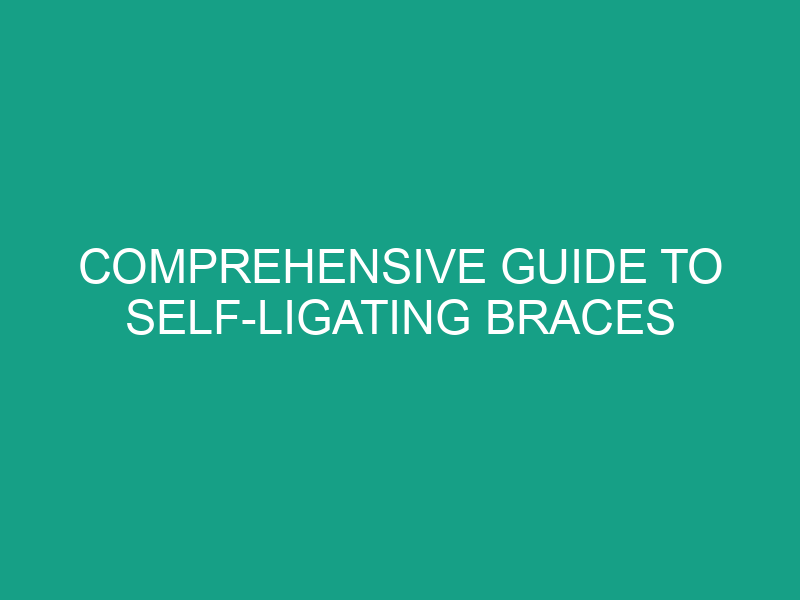 Comprehensive Guide to Self Ligating Braces
